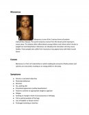 Marasmus - Protein-Malnutrition Disease